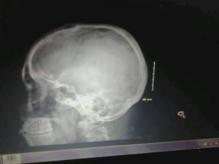 skull skull